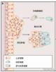 90的癌症死亡与转移相关，癌症是如何转移的？
